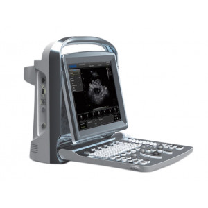 33994 - ECOGRAFO CHISON ECO-1 VET